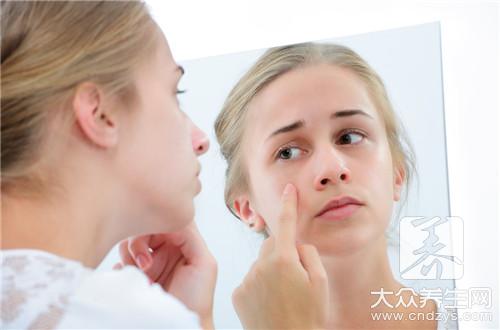  脸上长脓痘不可频繁抹脸