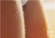 如何去鸡皮疙瘩?用三方法消除效果最佳
