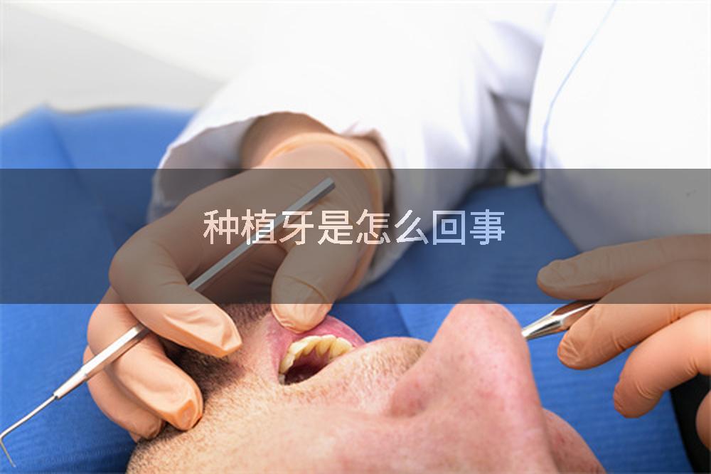 种植牙是怎么回事