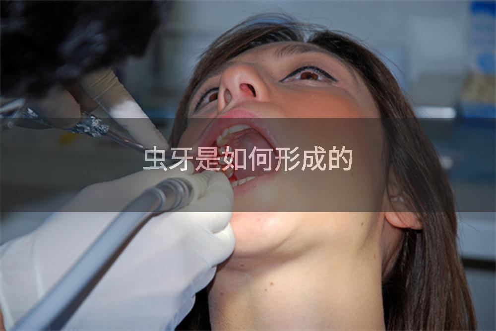 虫牙是如何形成的
