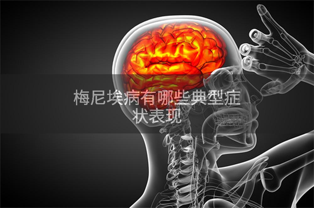 梅尼埃病有哪些典型症状表现