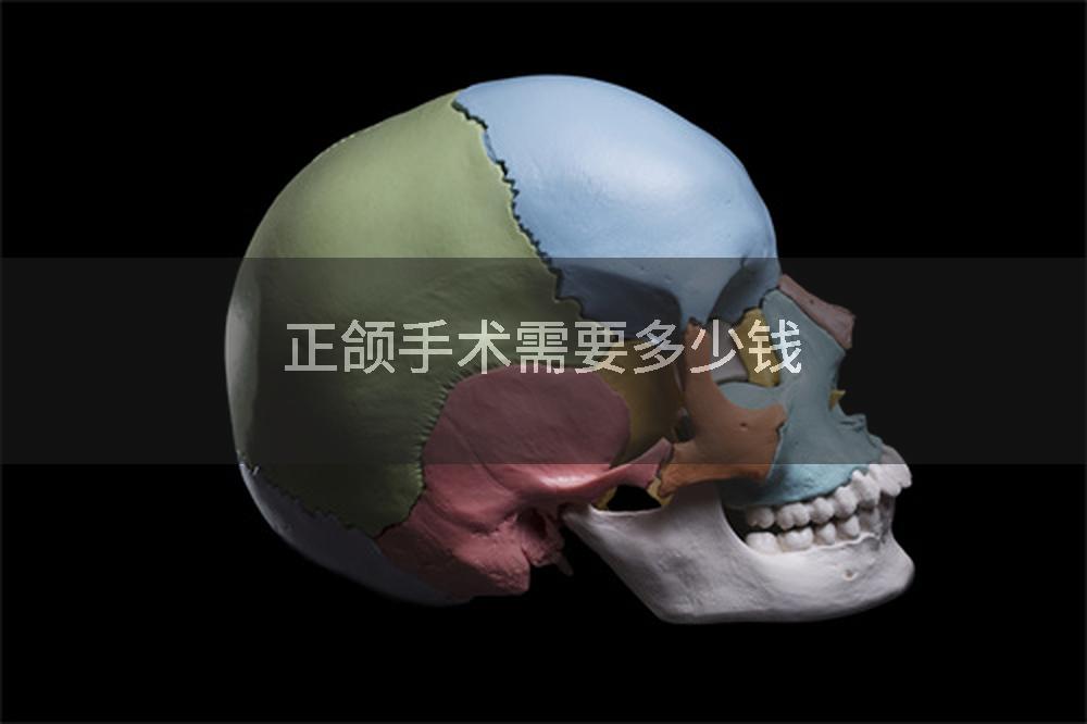 正颌手术需要多少钱