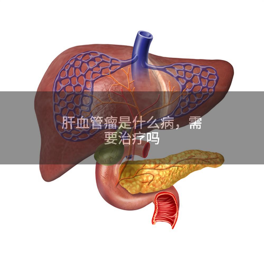肝血管瘤是什么病，需要治疗吗