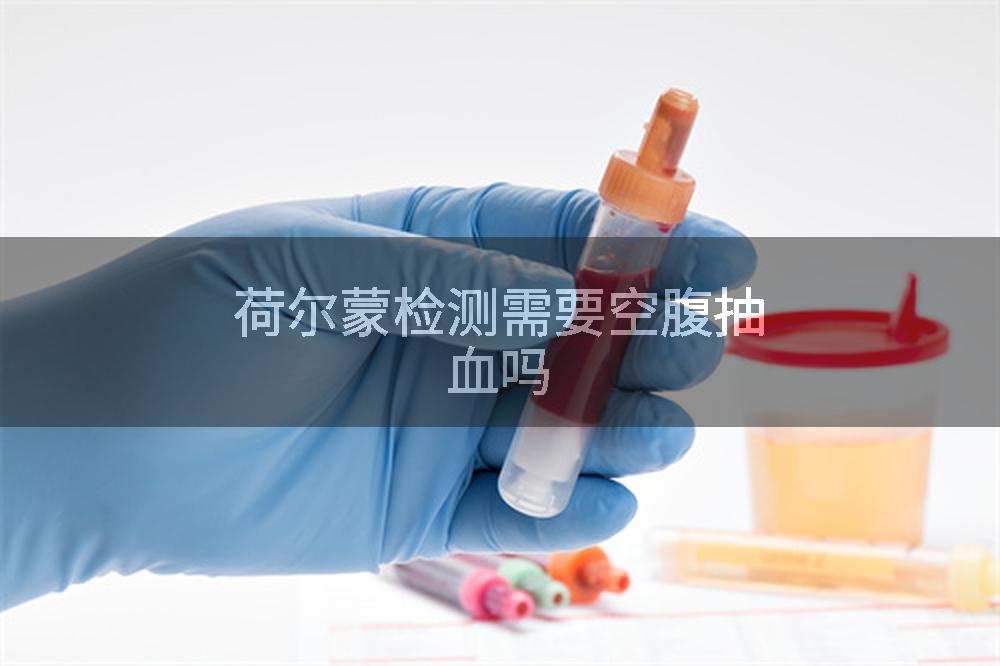 荷尔蒙检测需要空腹抽血吗