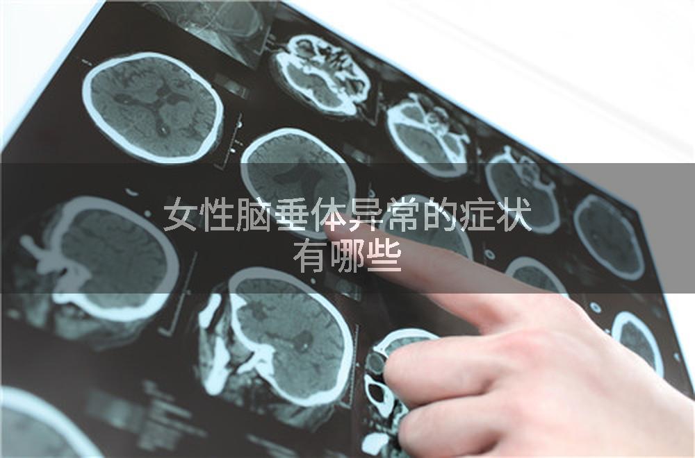 女性脑垂体异常的症状有哪些