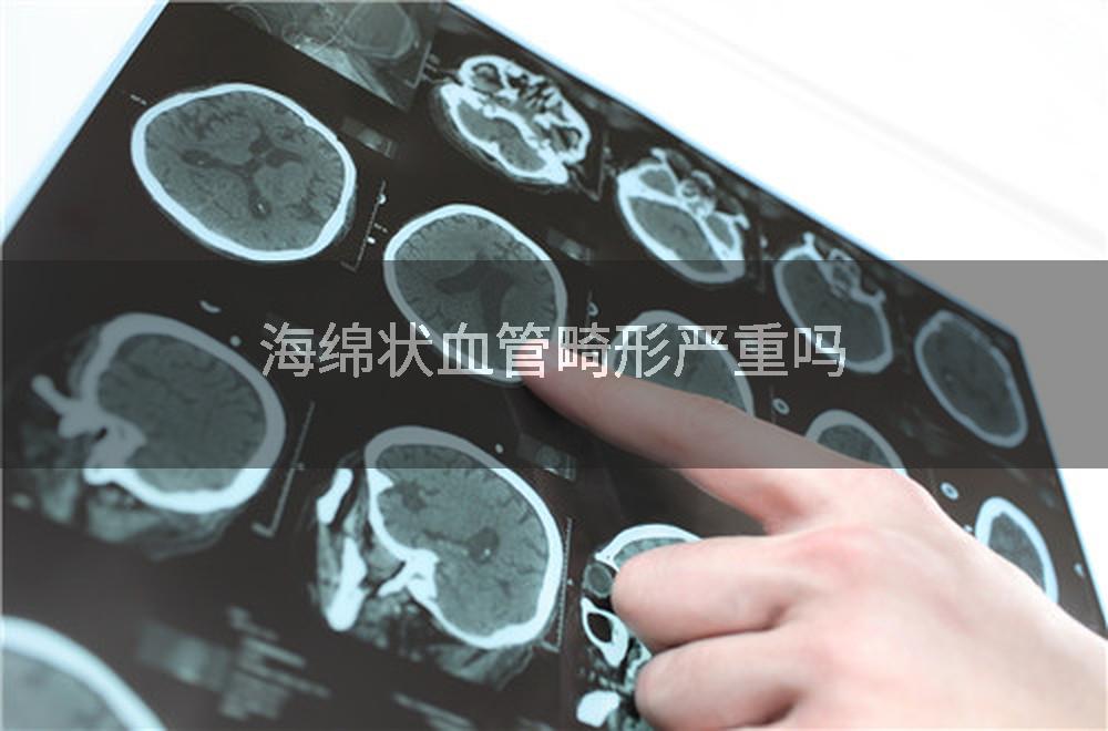 海绵状血管畸形严重吗