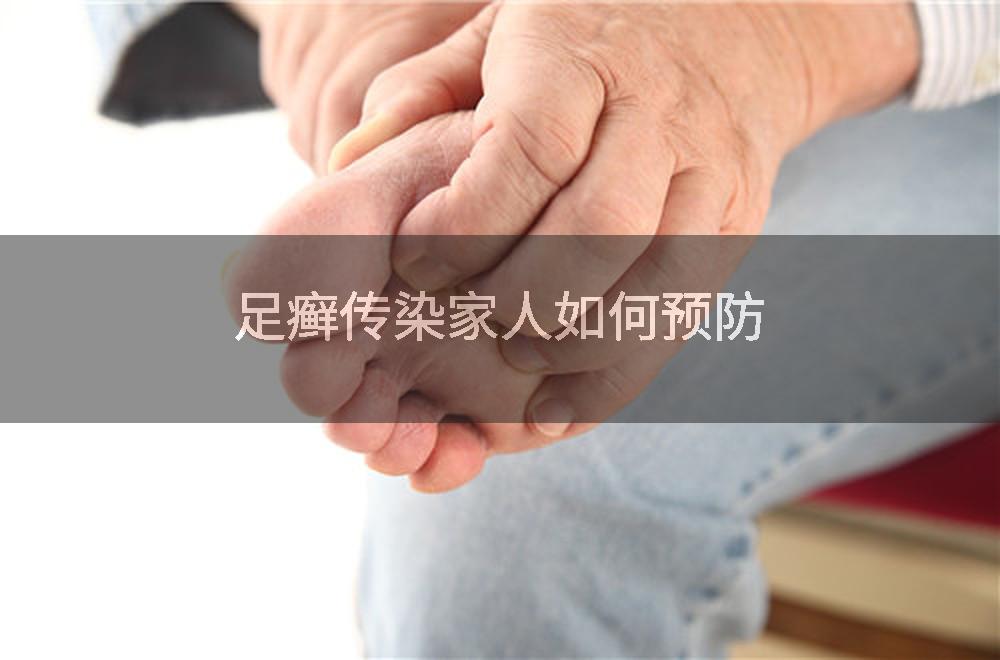 足癣传染家人如何预防