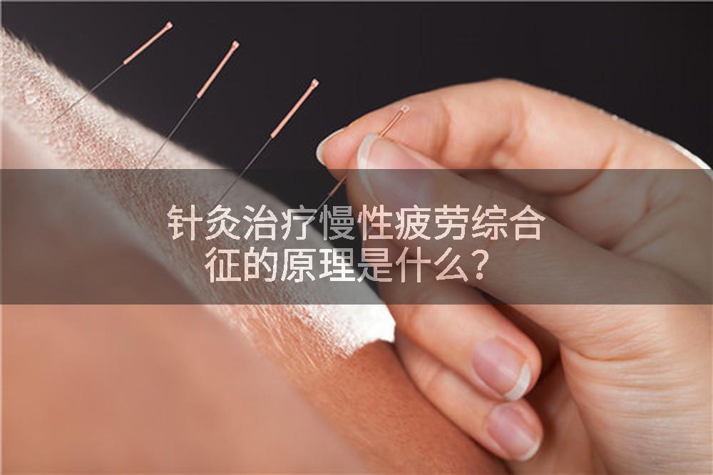 针灸治疗慢性疲劳综合征的原理是什么？