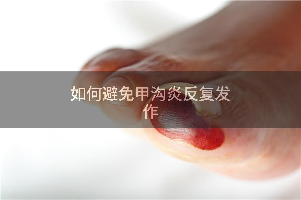 如何避免甲沟炎反复发作