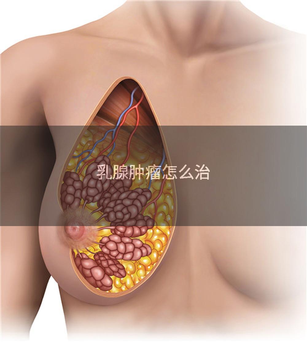 乳腺肿瘤怎么治