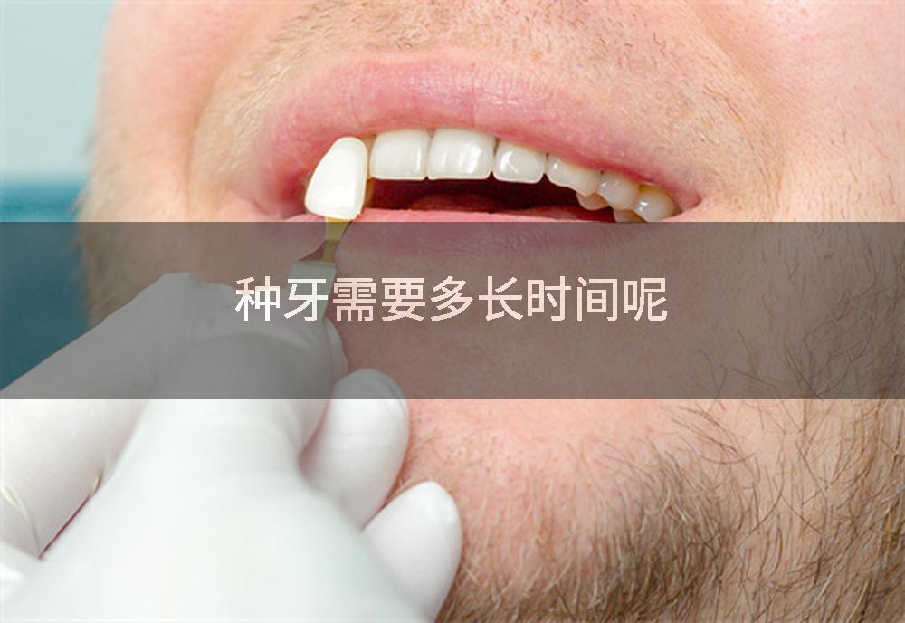种牙需要多长时间呢