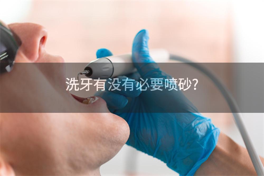 洗牙有没有必要喷砂?