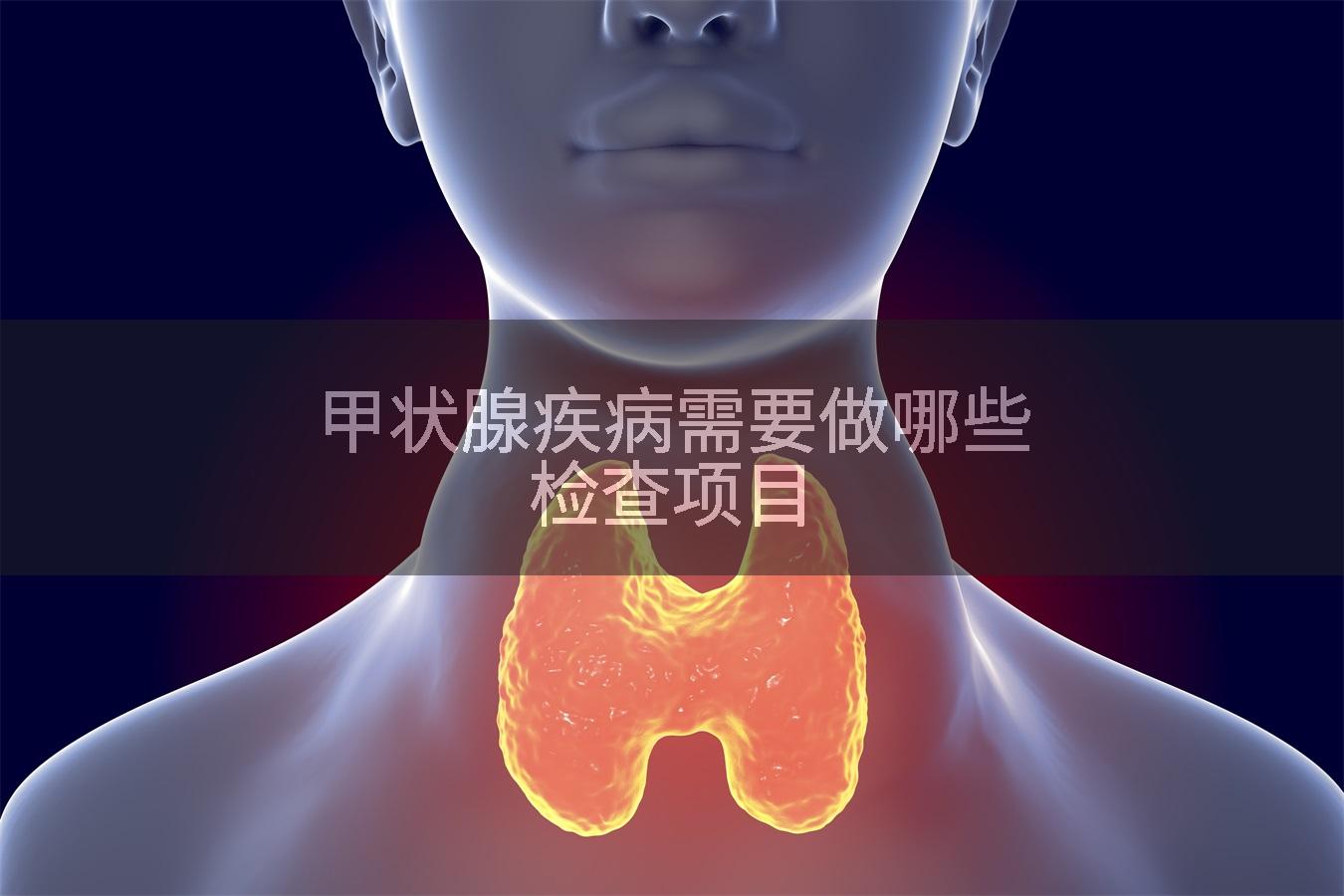 甲状腺疾病需要做哪些检查项目