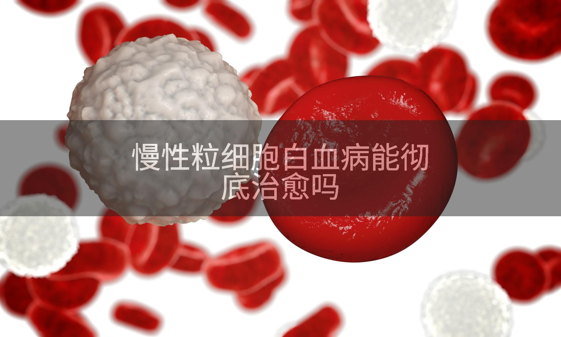 慢性粒细胞白血病能彻底治愈吗