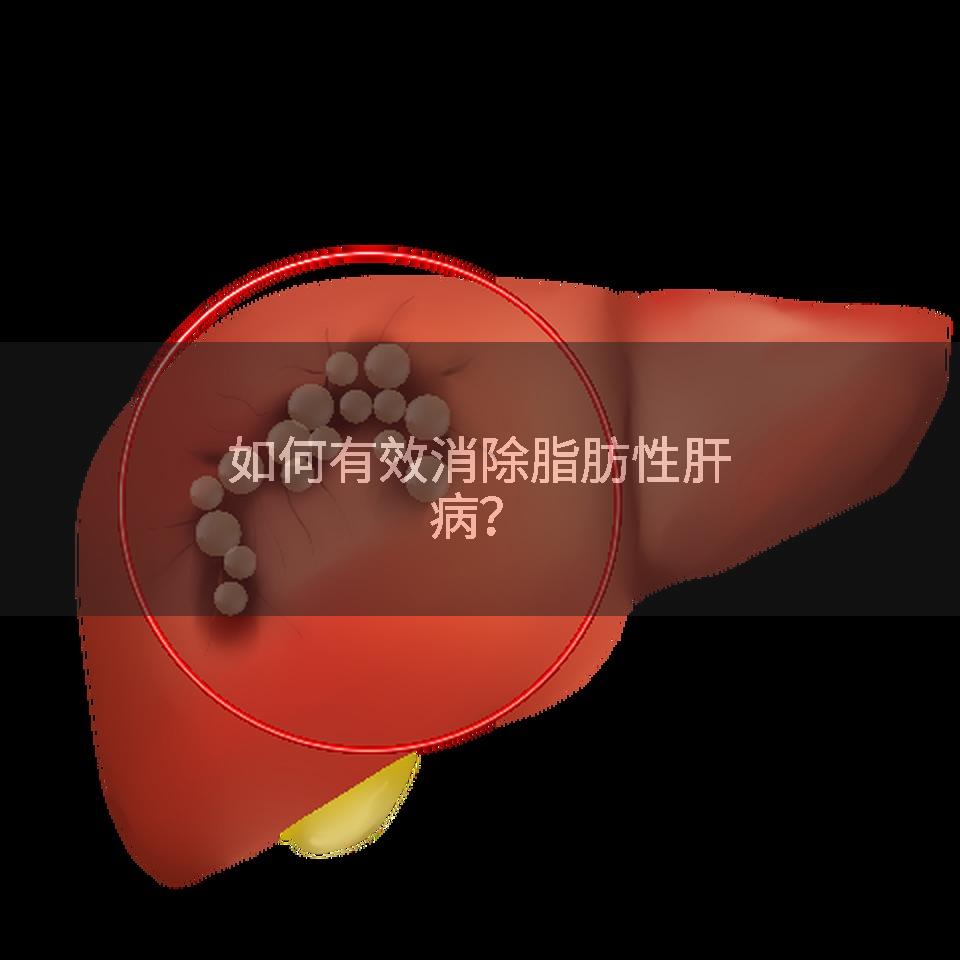 如何有效消除脂肪性肝病？