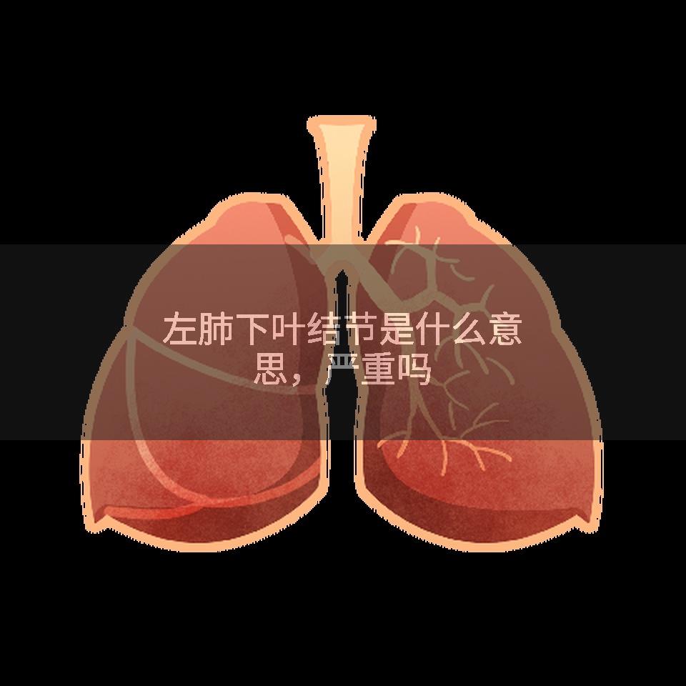 左肺下叶结节是什么意思，严重吗