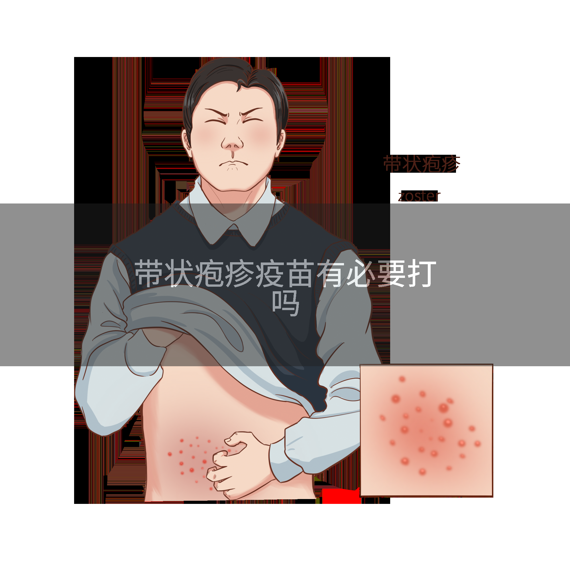 带状疱疹疫苗有必要打吗