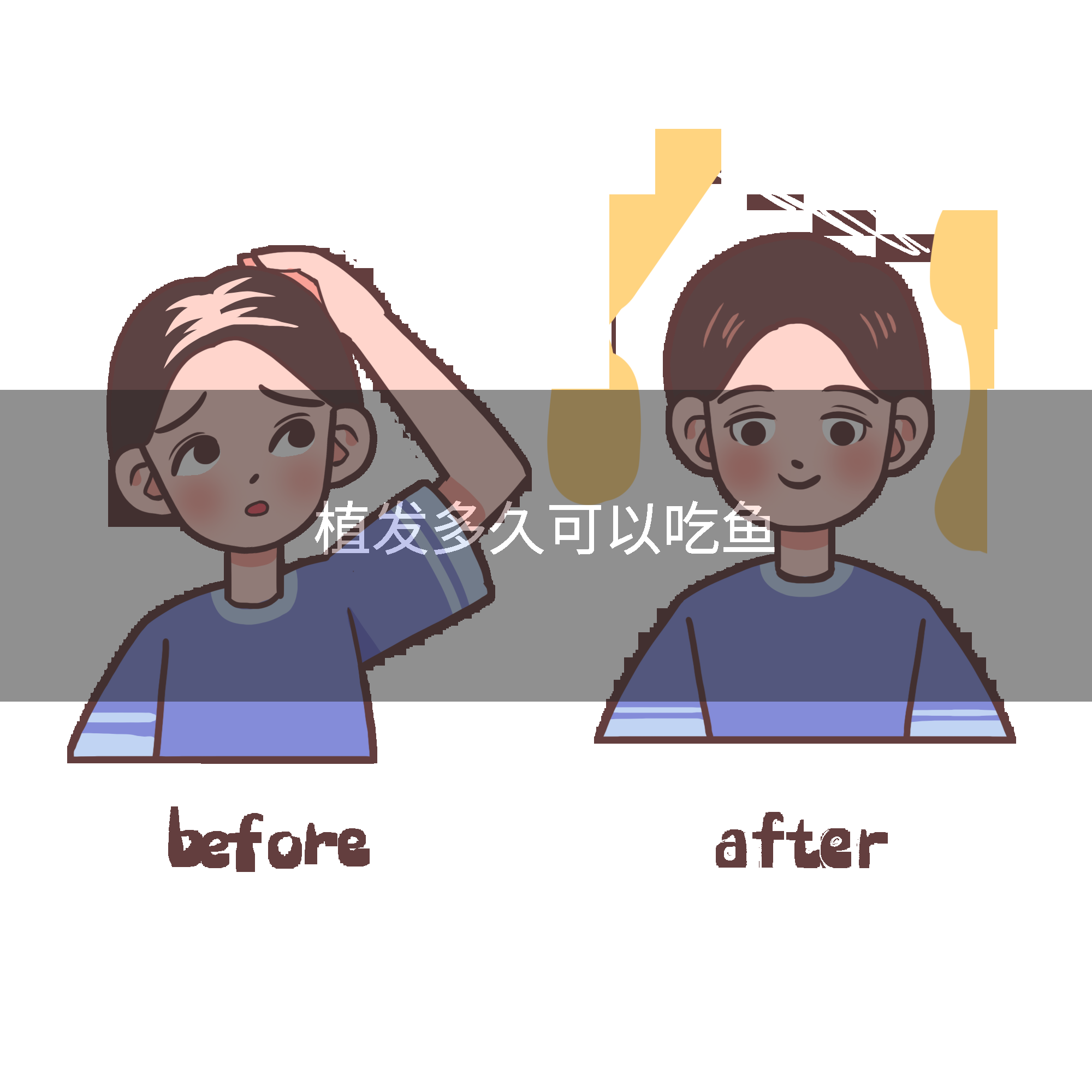 植发多久可以吃鱼