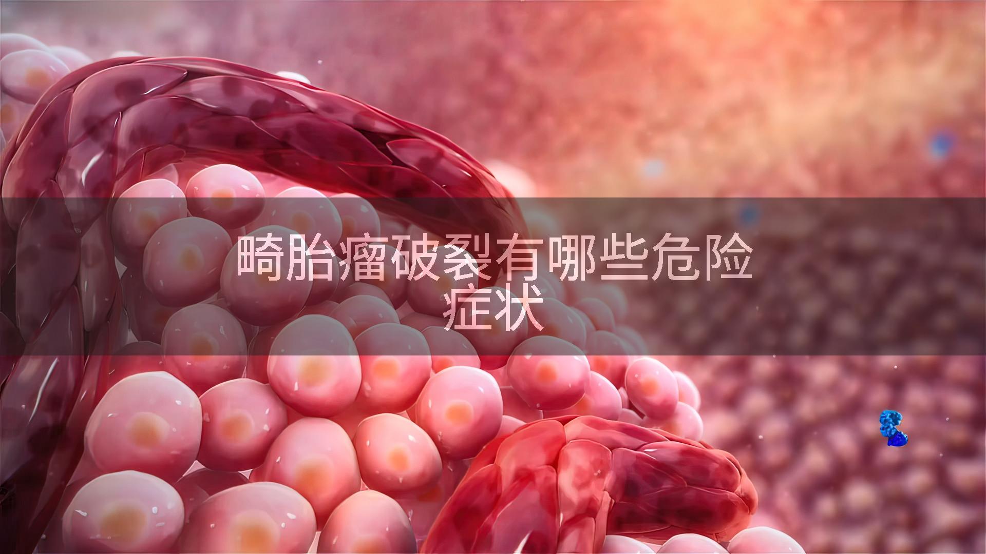 畸胎瘤破裂有哪些危险症状