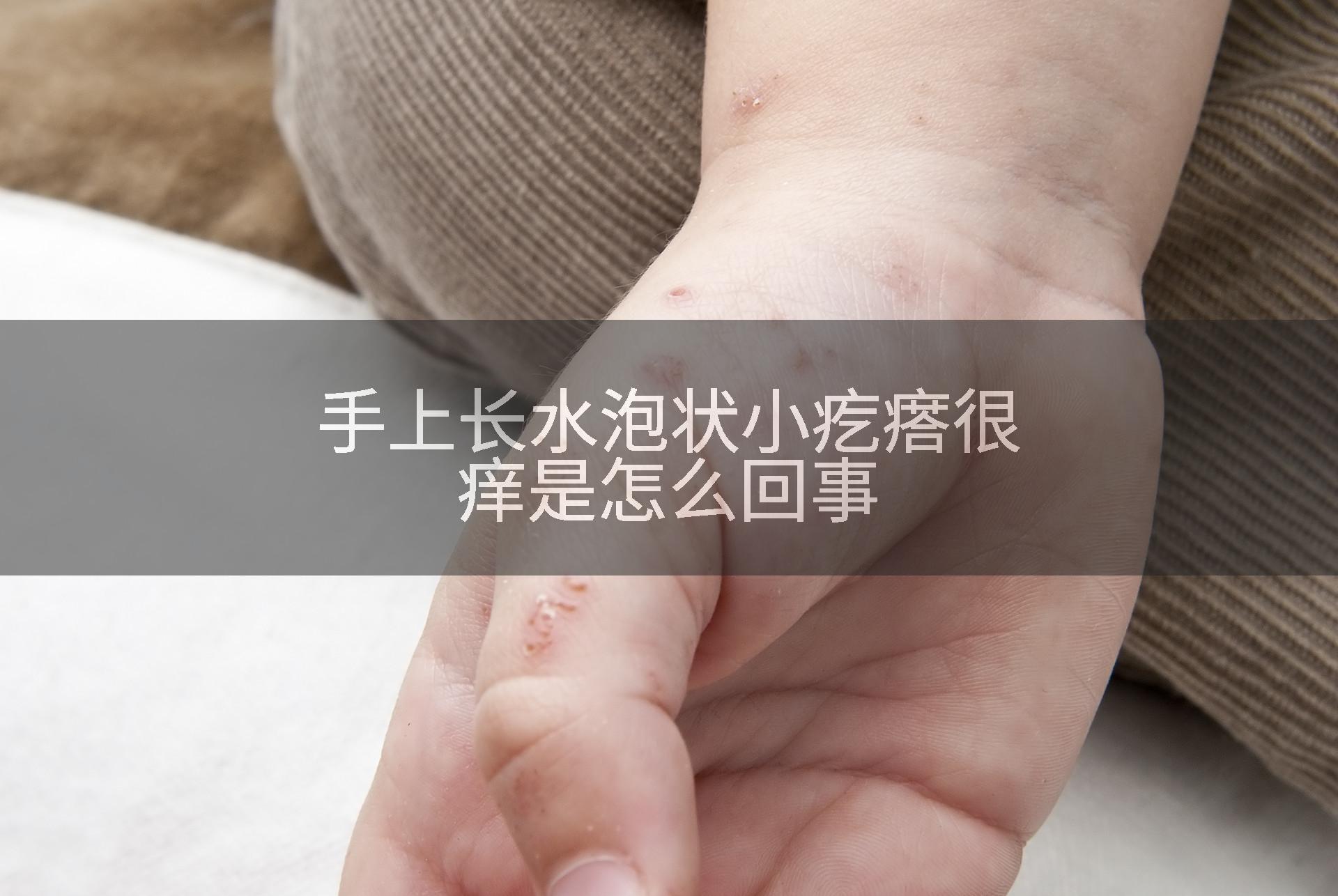 手上长水泡状小疙瘩很痒是怎么回事
