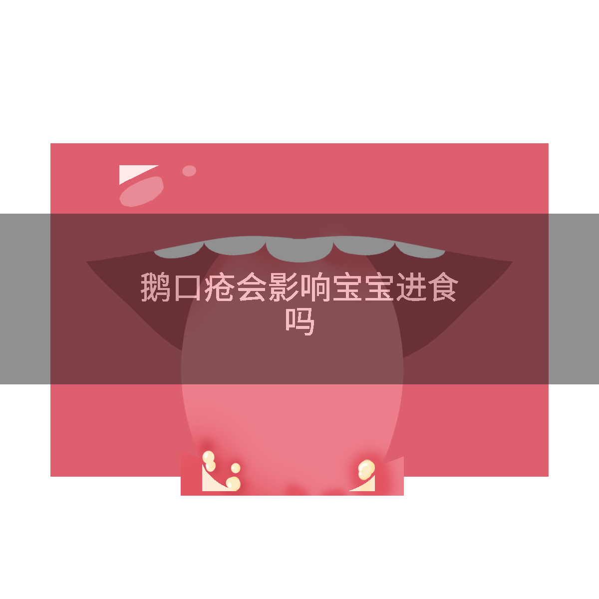 鹅口疮会影响宝宝进食吗