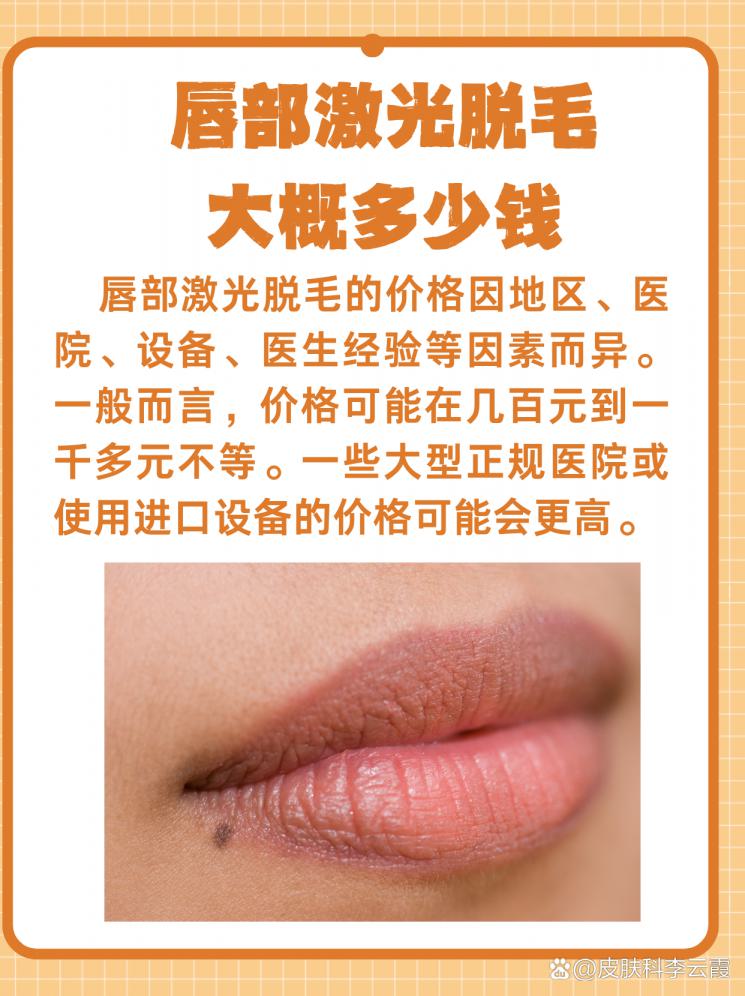 唇部激光脱毛，轻松告别小胡子！