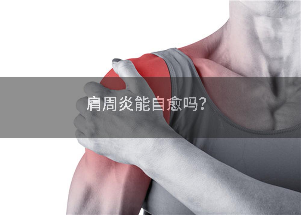 肩周炎能自愈吗？