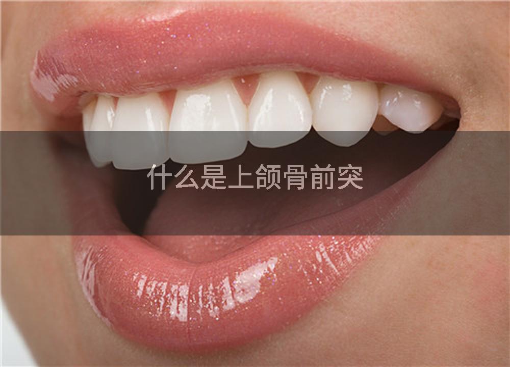 什么是上颌骨前突