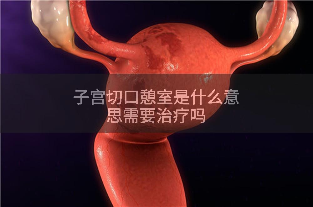 子宫切口憩室是什么意思需要治疗吗