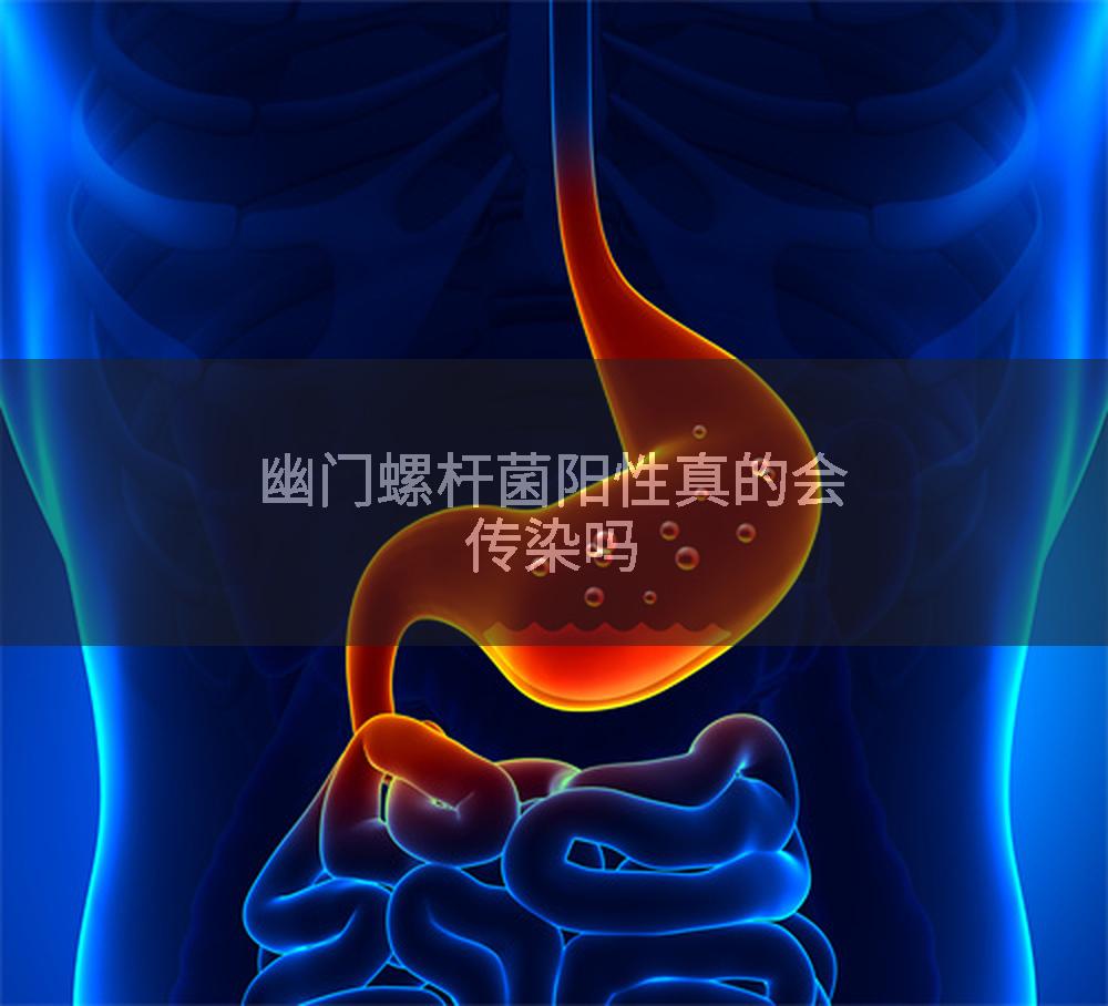 幽门螺杆菌阳性真的会传染吗