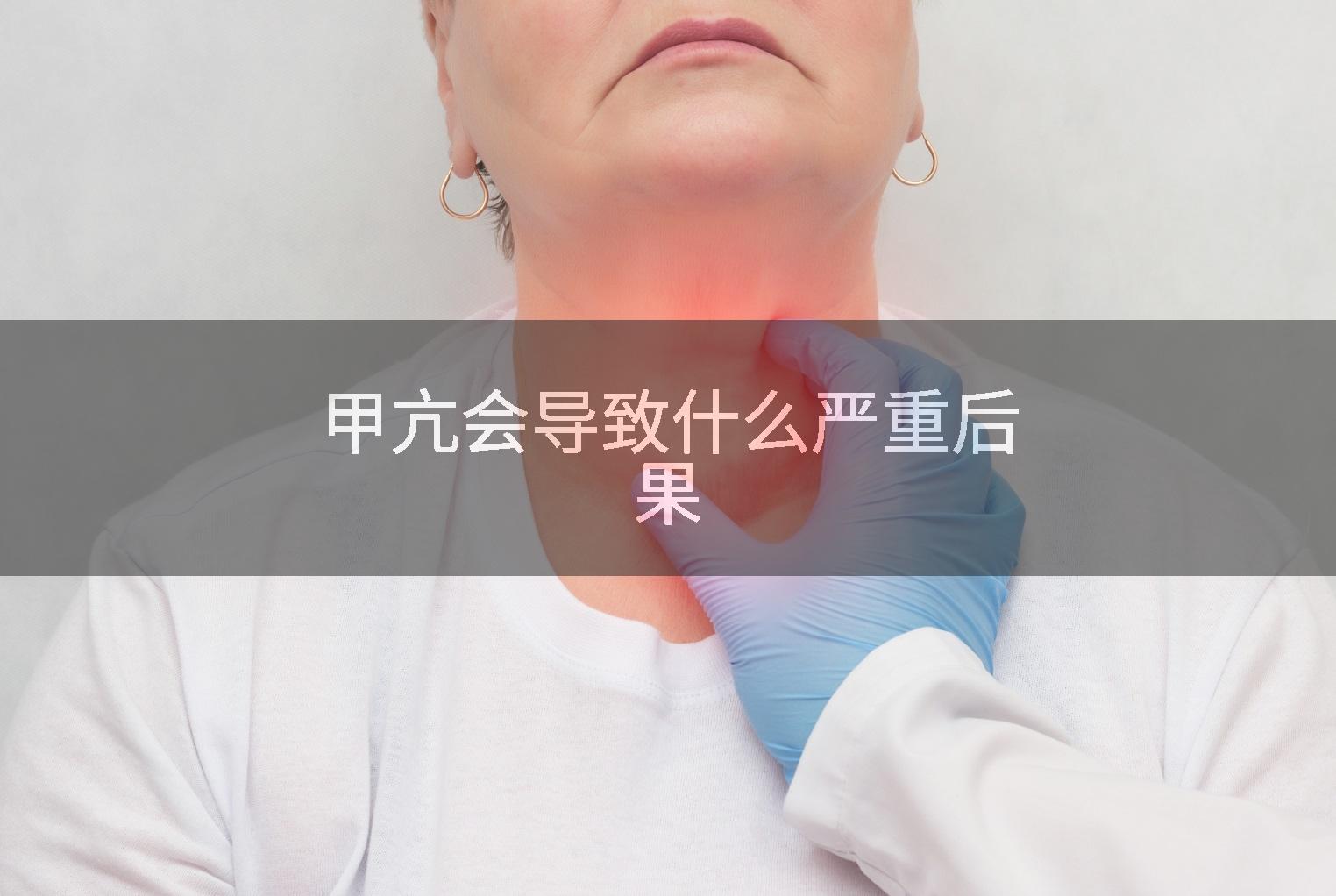 甲亢会导致什么严重后果